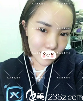 术后第六天情况 术后第六天情况