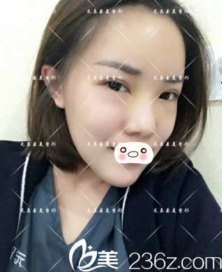 术后第八天恢复效果 术后第八天恢复效果