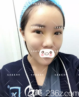 第十天的效果情况 第十天的效果情况