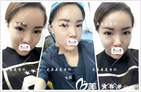 半个月恢复程度 半个月恢复程度