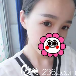 术后十天恢复效果