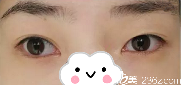 我手术之前的照片 我手术之前的照片