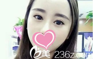 术后19天 术后19天