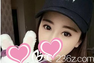 找包头丽人陈秀芳割了个双眼皮 二十天里我拍了N张图片