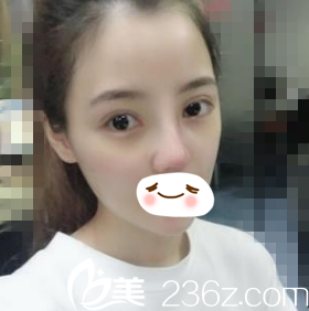 术后一周拆线 术后一周拆线