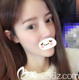 术后二十天恢复情况 术后二十天恢复情况