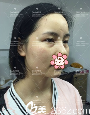 同事介绍我去重庆曹阳丽格医院 同事介绍我去重庆曹阳丽格医院