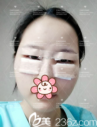 术后当天 术后当天