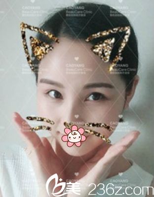 没眼袋了就是好看 没眼袋了就是好看