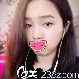 术前照片 术前照片