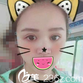 半个月恢复情况 半个月恢复情况