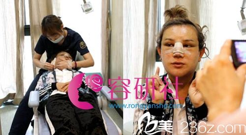 韩国丽珍整形外科SMAS提升治疗与护理