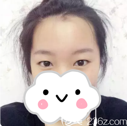 手术前的我 手术前的我