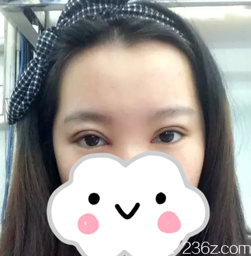 术后四天 术后四天