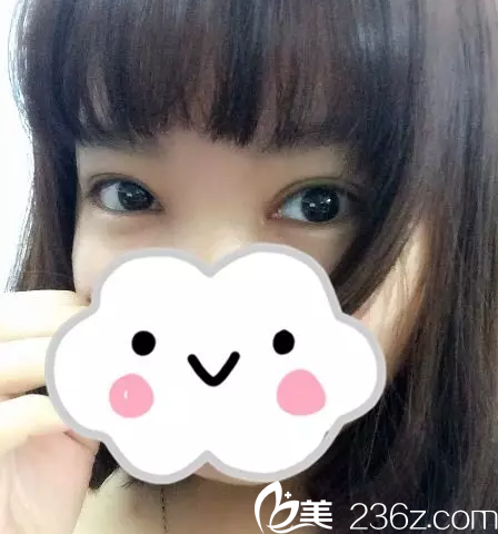 术后一周 术后一周