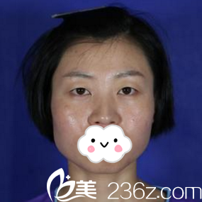 术前照片 术前照片