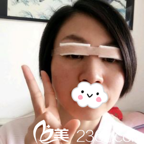 术后当天即刻效果 术后当天即刻效果