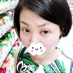 开始消肿 开始消肿