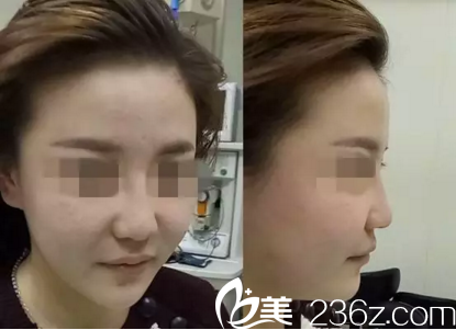 手术前的我 手术前的我