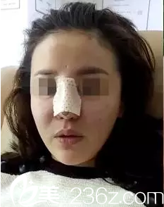 术后当天的我 术后当天的我