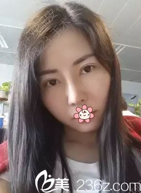 工作忙，憔悴啊