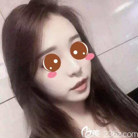 韩国BE&ME朴晋弘韩式半纹眉真人案例术后第三天 韩国BE&ME朴晋弘韩式半纹眉真人案例术后第三天