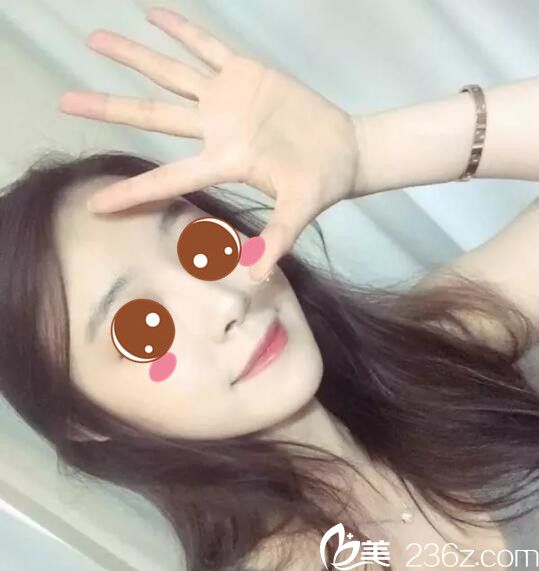 韩国BE&ME朴晋弘韩式半纹眉真人案例术后第七天 韩国BE&ME朴晋弘韩式半纹眉真人案例术后第七天