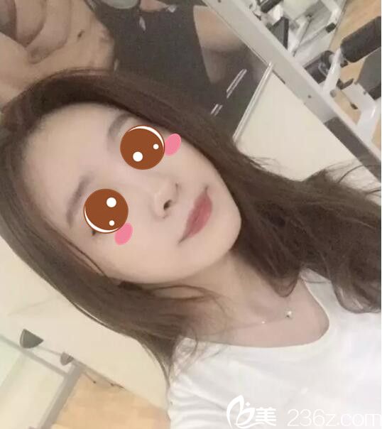 韩国BE&ME朴晋弘韩式半纹眉真人案例术后一个月 韩国BE&ME朴晋弘韩式半纹眉真人案例术后一个月