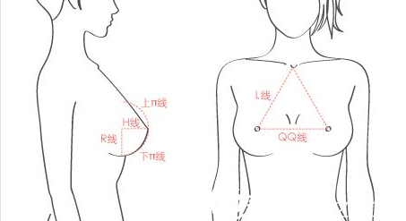 桂林假体隆胸贵不贵？桂林诺澜登隆胸手术38900元起就能拥有美胸