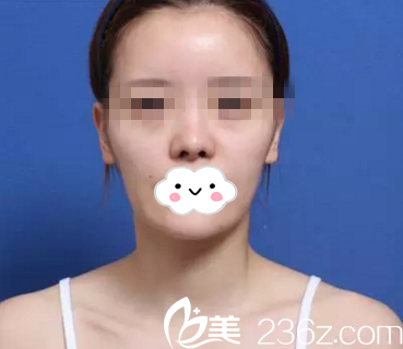 手术前的我 手术前的我