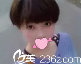 手术正面照 手术正面照