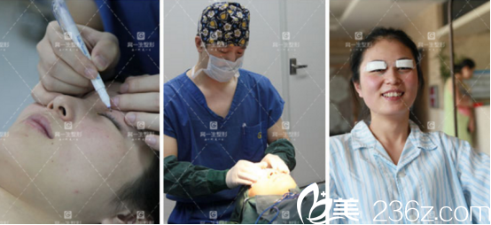 这是我手术刚做完的样子 这是我手术刚做完的样子