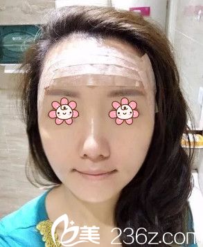  王世宏医生给我做完手术第二天