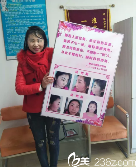 淮安市一院医学美容中心祛斑效果好，女孩自制对比图感谢陈芳医生