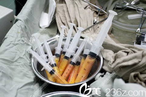 手术中先抽取脂肪 手术中先抽取脂肪