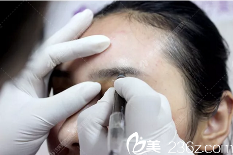 纹眉术过程中 纹眉术过程中
