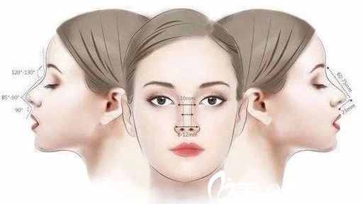 长春长青丽人隆鼻多少钱？鼻综合手术18900元起就能拥有