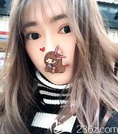 在<!--<i data=20240703-sp></i>-->整形割的双眼皮