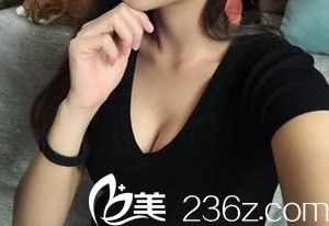晏传涛自体脂肪隆胸手术案例 晏传涛自体脂肪隆胸手术案例