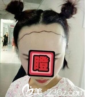 手术前设计 手术前设计