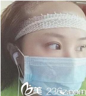 移植后两天效果 移植后两天效果