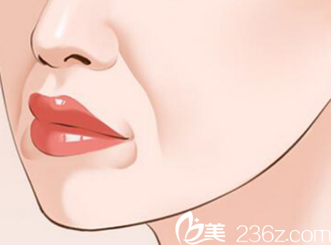 面部有法令纹老十岁？南宁农霖自体脂肪祛除法令纹9980元起帮你去除