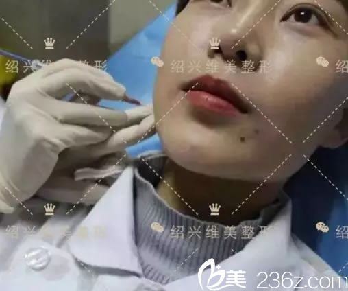 绍兴维美注射瘦脸过程
