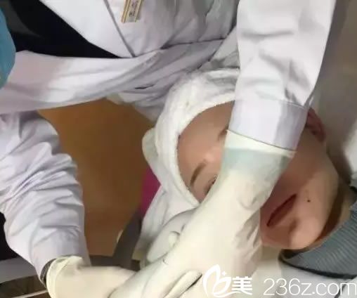 绍兴维美激光祛斑过程