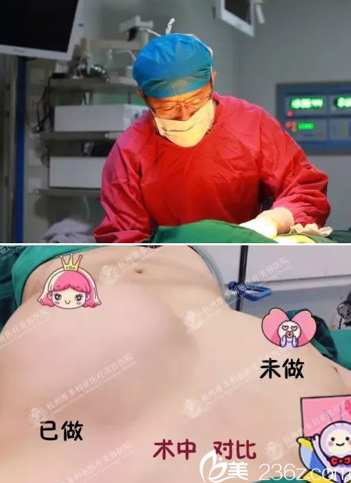 维多利亚刘中策自体脂肪隆胸过程