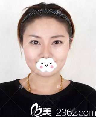 术后20天恢复情况 术后20天恢复情况