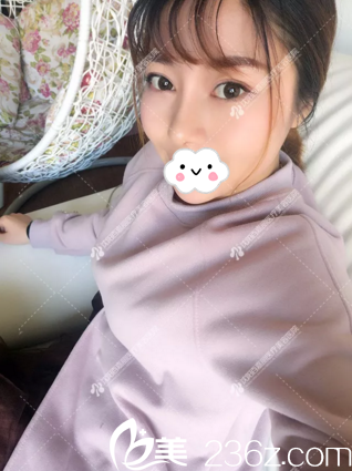 鼻综合术1年恢复情况 鼻综合术1年恢复情况