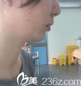 西安高一生医院高秀梅做光纤溶脂面部的<span style= 西安高一生医院高秀梅做光纤溶脂面部的<span style=