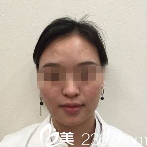 手术前的我 手术前的我