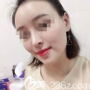 术后半个月 术后半个月